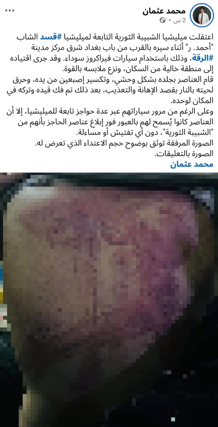 جرائم وانتهاكات الشبيبة الثورية وقسد بحق المدنيين في الرقة والجزيرة العربية السورية... حسبنا الله ون...